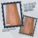WoundWorx Wound Gel